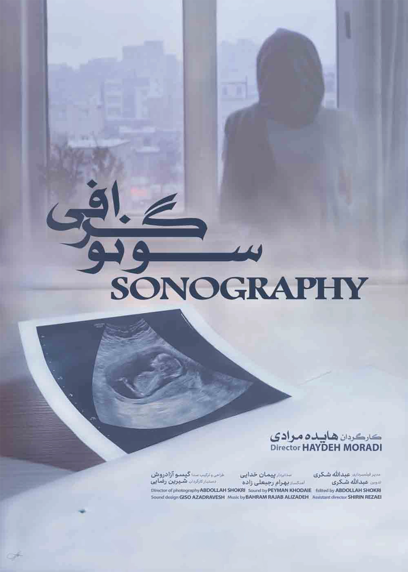 سونوگرافی